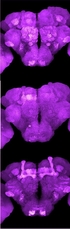 Spermidine Protects the Aging Memory