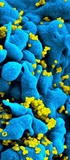 Metapopulation Modelling of HIV Infection Dynamics